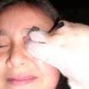anterior